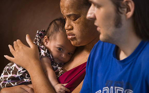 Erika Johnson, center, and Blake Sinnett, right, of Kansas City, Missouri, both of whom are legally blind, welcomed home their two-month-old baby, Mikaela Sinnett, July 20, 2010, after having Mikaela taken away from them by a protective custody ruling because both parents are blind. After challenging the ruling of protective custody, Mikaela was returned to her parents after 57 days in foster care. (David Eulitt/Kansas City Star/MCT)